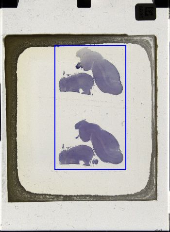 Media type: image; Special Collections 3043   shows specimen_part histological serial section;